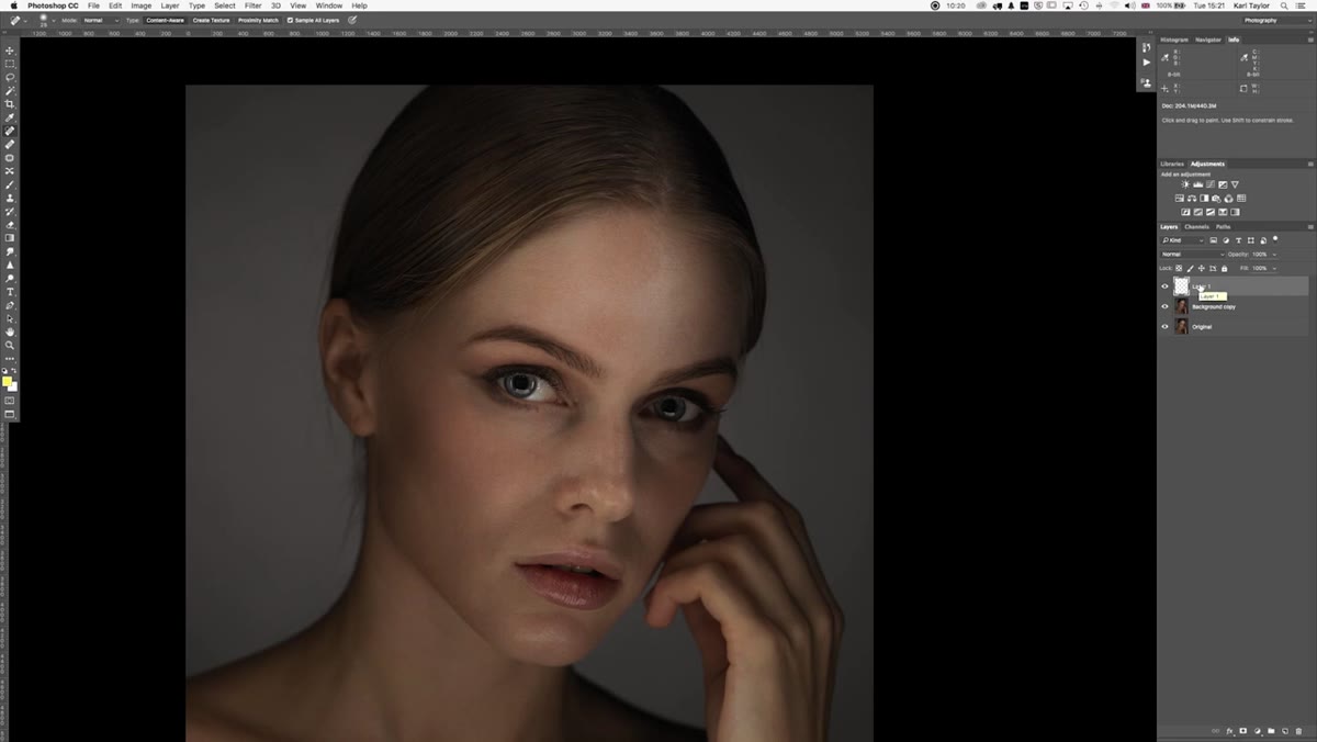 Zoomed-in skin showing healed blemishes and texture