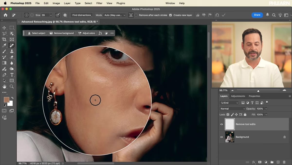 Full portrait view showing uneven skin tone patches