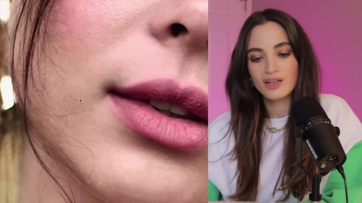 Close-up of skin area where blemish retouch went wrong
